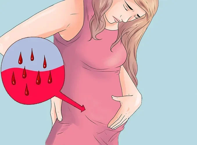 انواع خونریزی در بارداری و دلیل خونریزی در بارداری چیست؟