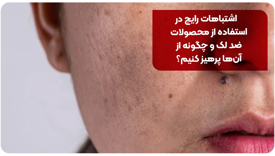 اشتباهات رایج در استفاده از محصولات ضد لک و چگونه از آن&zwnj;ها پرهیز کنیم؟