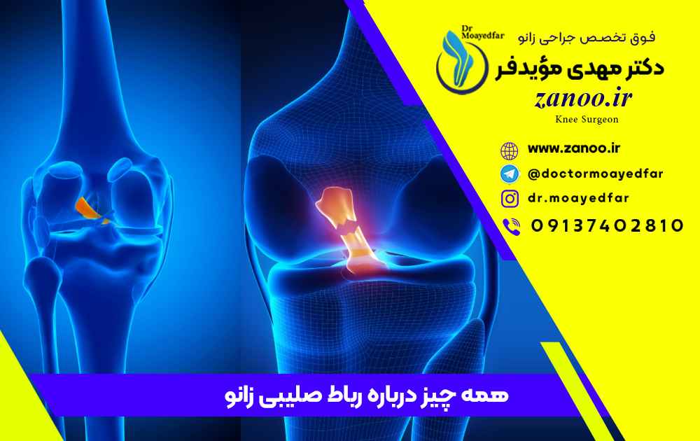 بهترین جراح عمل جراحی رباط صلیبی زانو