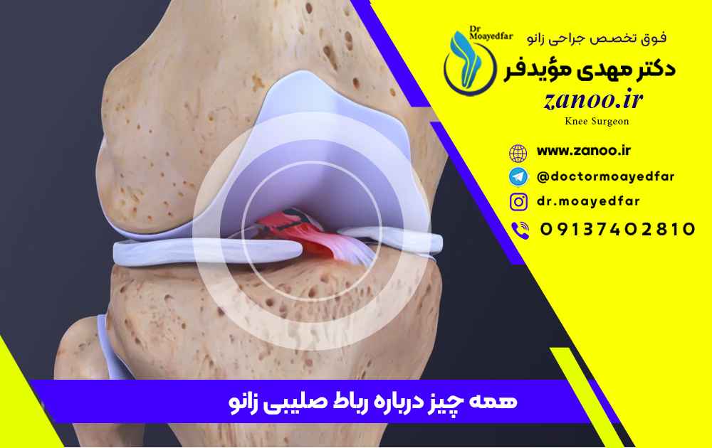  جراحی رباط صلیبی زانو