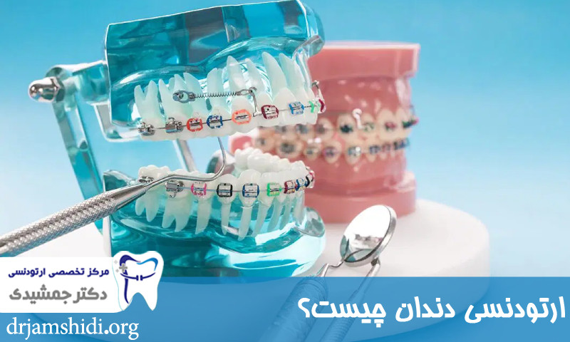 کدام ارتودنسی برای شما مناسب است ؟ بهترین راهنما